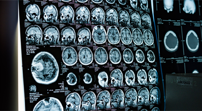New White Paper: The Value of Generic Contrast Utilization in Imaging
